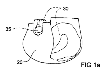 Measurement for a diaper – T 2803/18 – 13 December 2022